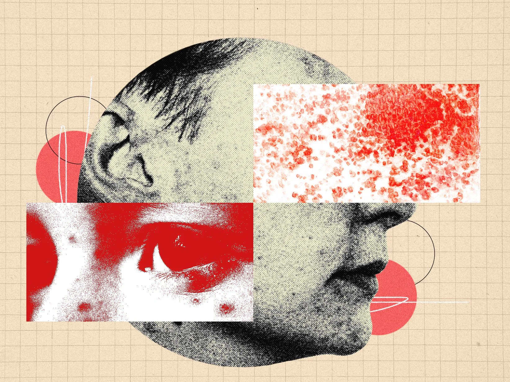 How Shingles Technology Could Impact Your Health Data Security